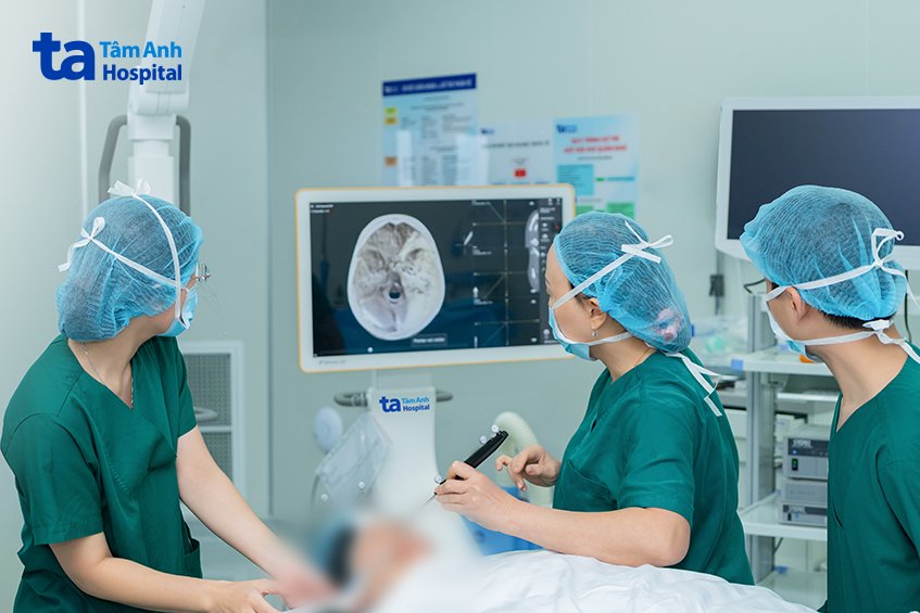 Ứng dụng trí tuệ nhân tạo (AI) phẫu thuật mũi xoang 5 dùng AI chữa mũi xoang