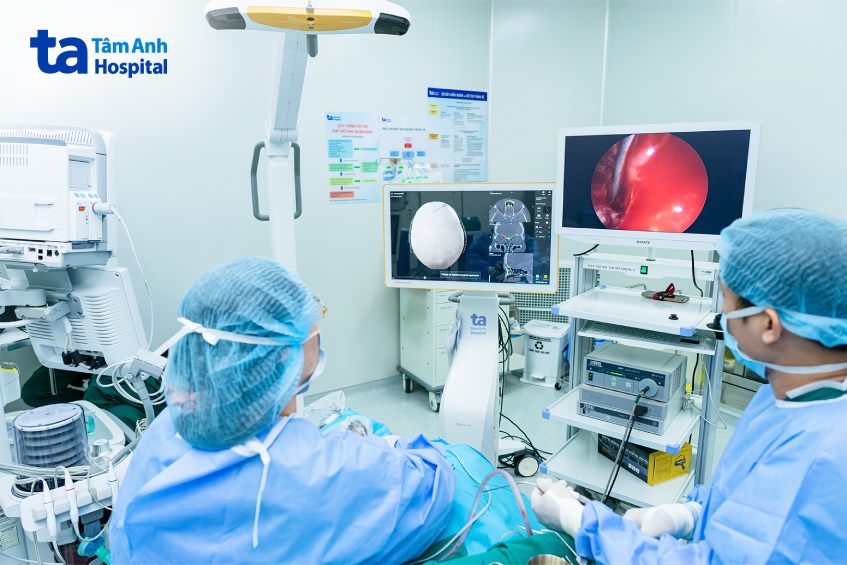 Ứng dụng trí tuệ nhân tạo (AI) phẫu thuật mũi xoang 2 dùng AI trị mũi xoang