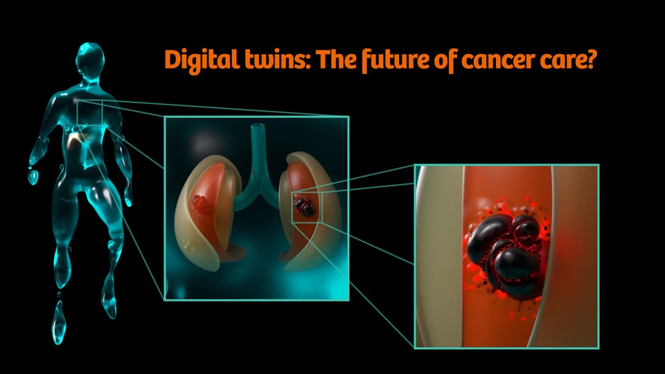 Thử nghiệm điều trị ung thư bằng AI và công nghệ song sinh kỹ thuật số - Ảnh 1. Thử nghiệm điều trị ung thư bằng AI và công nghệ song sinh kỹ thuật số - Ảnh 1.